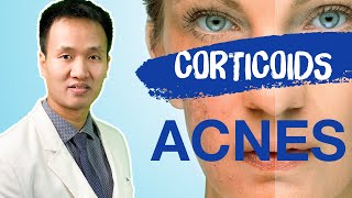 Corticoids  Liệu BẠN đã HIỂU ĐÚNG về tại biến  tác dụng phụ  Dr Hiếu [upl. by Avilla]