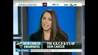 Views of Dr Jessica Krant on Melanoma in MSNBC Interview  Art of Dermatology [upl. by Rehpotsrik481]