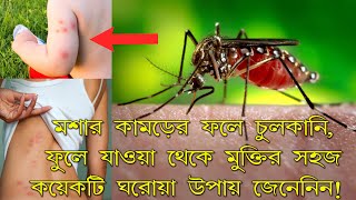 মশার কামড়ের ফলে চুলকানিফুলেযাওয়া থেকে মুক্তির সহজ কয়েকটি ঘরোয়া উপায় জানুন mosquito bite treatment [upl. by Fagaly]