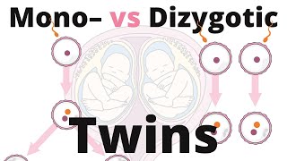 Difference between Monozygotic and Dizygotic Twins [upl. by Neilla]