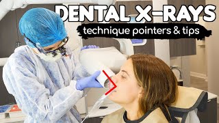 How To Take PERFECT Dental Xrays  Tips amp Tricks From A Dental Hygienist [upl. by Hannazus]