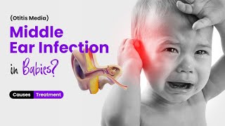 What is Middle Ear Infection Otitis Media in Babies Causes and Treatment Options  3D Guide [upl. by Son]