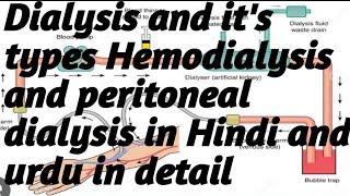 Dialysis and its types Hemodialysis and peritoneal dialysis in HindiUrdu in detail [upl. by Atinid77]