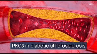 PKCδ regulates blood vessel biology in diabetic atherosclerosis [upl. by Harmonia324]