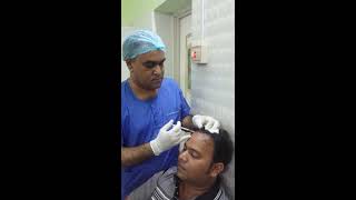 PRP therapy for Hair loss treatment [upl. by Yadrahc]