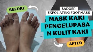 Sadoer Exfoliating foot mask Review  100 Review Jujur mask kaki pengelupasan kulit kaki [upl. by Verada193]