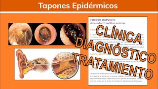 ⚕️🩺 Otocerosis TAPÓN DE CERÚMEN y Cuerpos Extraños  Otorrinolaringología [upl. by Idolah522]