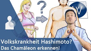 Hashimoto Thyreoiditis  Ein übles Chamäleon Übergewicht Müdigkeit Haarausfall amp weitere Symptome [upl. by Betteanne676]