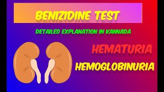 Benzidine test detailed explanation in KannadaBlood in urineDMLTBMLT [upl. by Anirbas383]