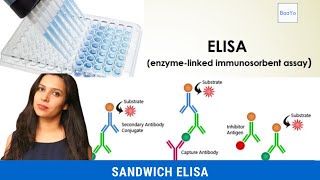 Sandwich ELISA  Basics Explained [upl. by Dickey]