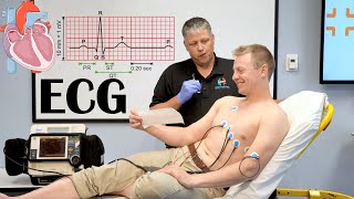 What Is ECG ElectrocardiogramEKG Indications How It Is Done And Basic Principles [upl. by Innavoeg]