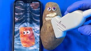 Potato Has CSection Live DiscountDentist FruitSurgery EmergencySurgery Satisfying ASMR [upl. by Barbee825]