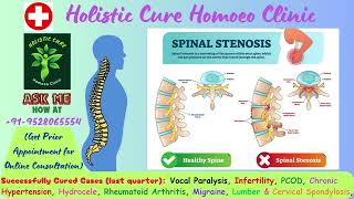 Spinal Stenosis [upl. by Dinsmore]