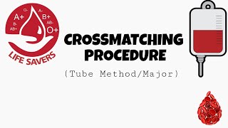 Crossmatching Procedure  Tube methodMajor [upl. by Anaig842]