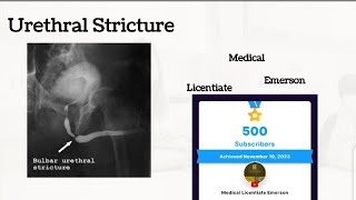 Urethral Strictures Lecture [upl. by Quirk]