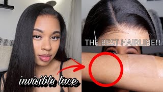 How Beginners Can Melt Lace Like A Pro The Best New Clear Scalp Lace Wig ft XrsBeauty Hair [upl. by Arakat]