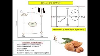 12DaysinMarch Valvular Heart Disease 7 Aortic Stenosis for the USMLE Step One Exam [upl. by Surovy]