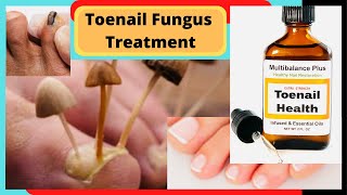 Natural Tonail Fungus Cure and Athletes Foot Cure Natural Fungus Killer by Nicoles Heart [upl. by Marfe]