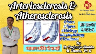 Arteriosclerosis and Atherosclerosis  Intro Types Etiology Pathophysiology BP 204T U2 L6 [upl. by Netsreik]