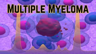 Multiple Myeloma Updated 2018  CRASH Medical Review Series [upl. by Maon]