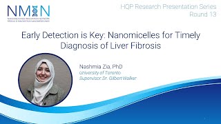 Early Detection is Key Nanomicelles for Timely Diagnosis of Liver Fibrosis [upl. by Ogdan]