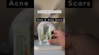 Banish Acne Scars with this✨️ shorts acne acneprone skincare [upl. by Ha377]