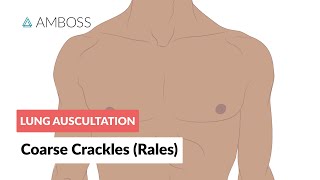 Coarse Crackles Rales  Lung Auscultation  Episode 3 [upl. by Philine617]