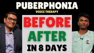 BeforeAfter Puberphonia Speech Therapy  Within 8 Days  SLPSanjayKumar  Speech Pathologist India [upl. by Bronk]