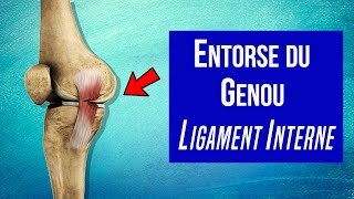 Soigner lentorse du ligament interne du genou  Les traitements [upl. by Hannavahs138]