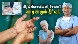 விரல்களில் வலி விரல் இருக்கம் வர காரணமும் தீர்வும்  Trigger Finger  tamil  Dr Jeya Venkatesh [upl. by Pitchford]