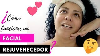 Facial rejuvenecedor con dermoabrasión y electroporación 👌 ¿FUNCIONA [upl. by Janet]