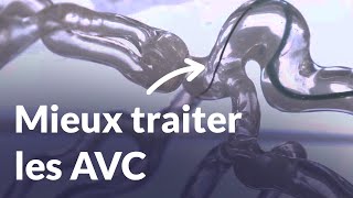 Une fibre biomédicale étudie les caillots sanguins pour comprendre les causes dun AVC  Reportage [upl. by Zephan]