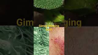 Gimpy bush berry can kill anyone shortsvideo gardening [upl. by Auka]