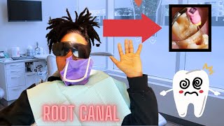 Root Canal LIVE Procedure  Dentist Visit Vlog [upl. by Ecirtnahs193]