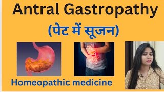 Antral Gastropathy पेट में सूजन treatment  Antral gastritis symptomscause amp homeopathic medicine [upl. by Ohploda]