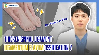 ligamentum flavum ossification [upl. by Derayne]