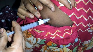 Arm IM Soma Ject Injection Push √√ Injection Videoজন্মবিরতিকরণ ইনজেকশন Ep 45 Injection Vision [upl. by Wren834]