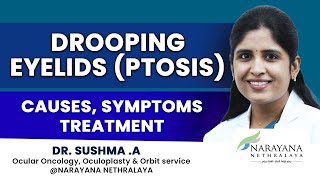 Drooping Eyelids Ptosis Know its Causes Symptoms and Treatment Kannada [upl. by Nawotna263]