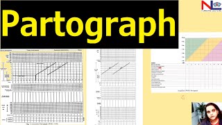 Partograph plotting  Nursing Lecture [upl. by Stinky]