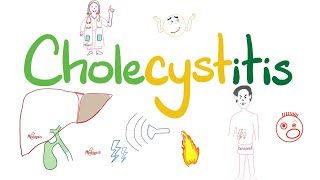 Cholecystitis  A Tale of One Cholelith  The most COMPREHENSIVE Review [upl. by Lunna]