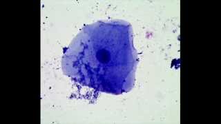 Cheek Epithelial Cells How to Prepare a Wet Mount Microscope Slide [upl. by Retsbew]