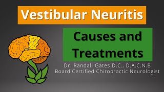 Vestibular Neuritis Causes and Treatment [upl. by Einnal]