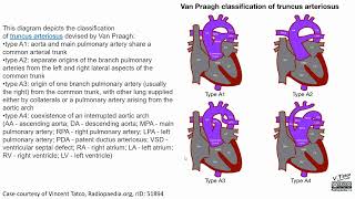 Truncus Arteriosus Imaging [upl. by Huda]