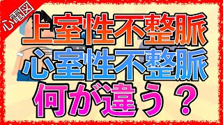 イラストで学ぶ医学！「上室性不整脈と心室性不整脈の違いとは？」QRS幅の広い狭いとは正常な心電図の読み方上室と心室の見分け方 [upl. by Salkcin]