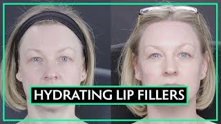 All About Hydrating Lip Fillers  Dr Sarah Tonks [upl. by Gerbold]