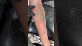 Xóa hình xăm ASRM⚡️Laser Tattoo Removal Da Nang Vietnam [upl. by Earased]