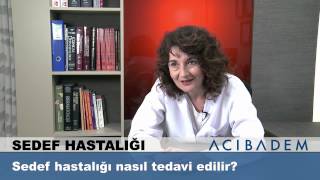 Sedef hastalığı nasıl tedavi edilir [upl. by Peg]