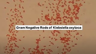 Klebsiella oxytoca in Gram Staining [upl. by Wright]