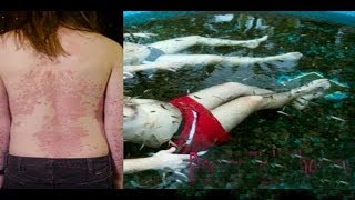 New Technology of Fish Spa Doctor Fish Psoriasis Cure Beautification [upl. by Bennie]