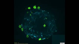 2023 BioArt Video Entry Ovarian Cancer 3D Spheroid amp Macrophage Fusion [upl. by Aman390]